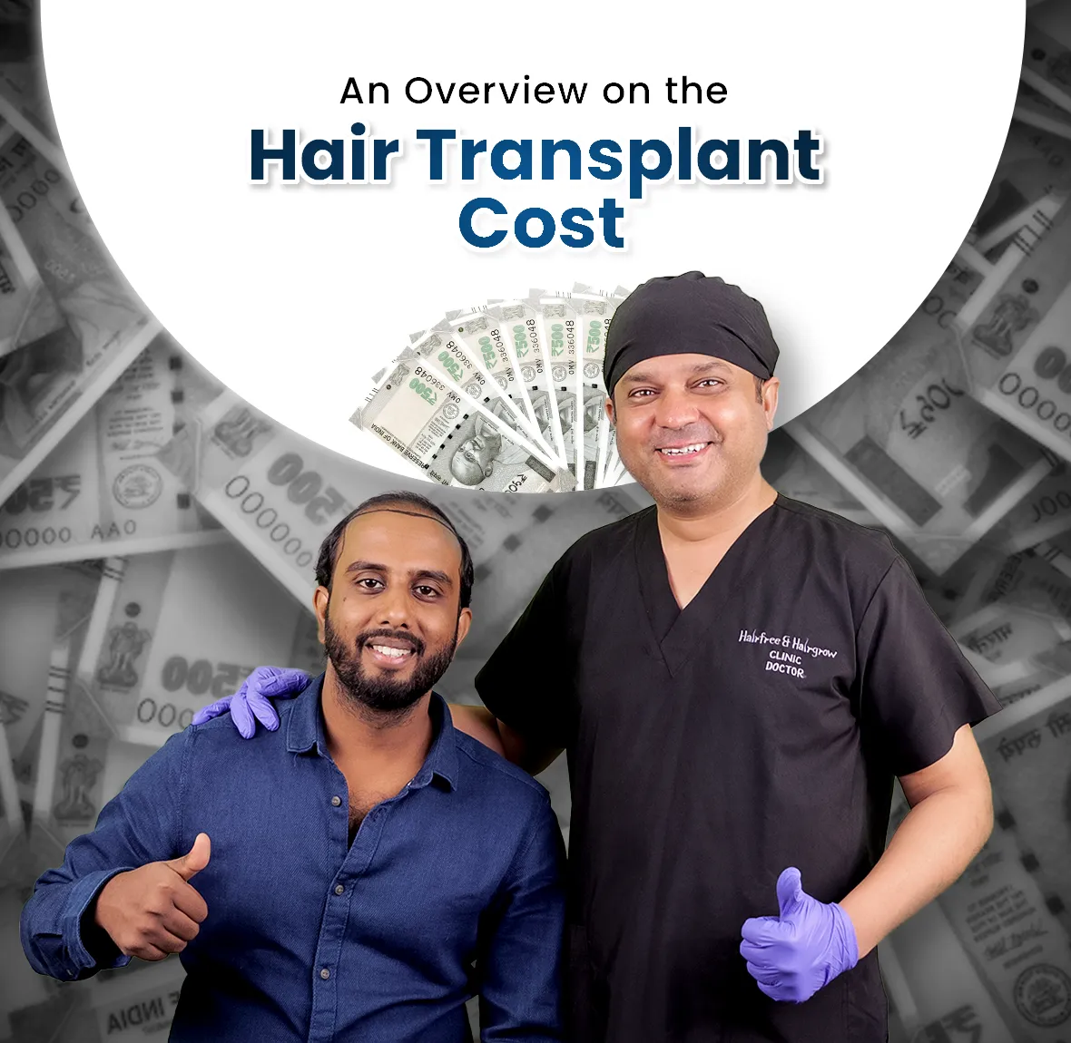 An Overview on the Hair Transplant Cost