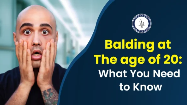 A shocked young man showing signs of balding at 20