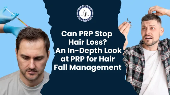 PRP Stop Hair Loss: How It Helps Hair Growth