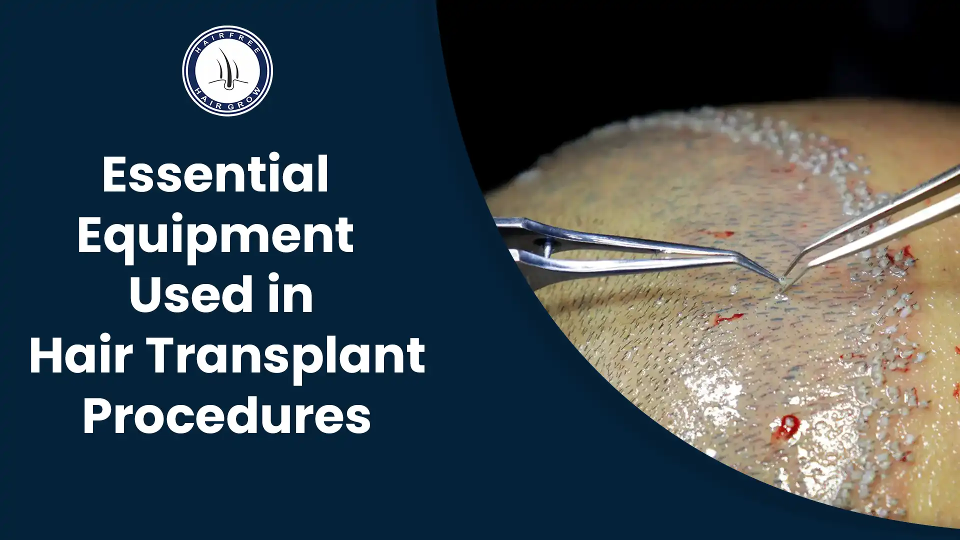 Hair Transplant Procedures: Essential Equipment Used
