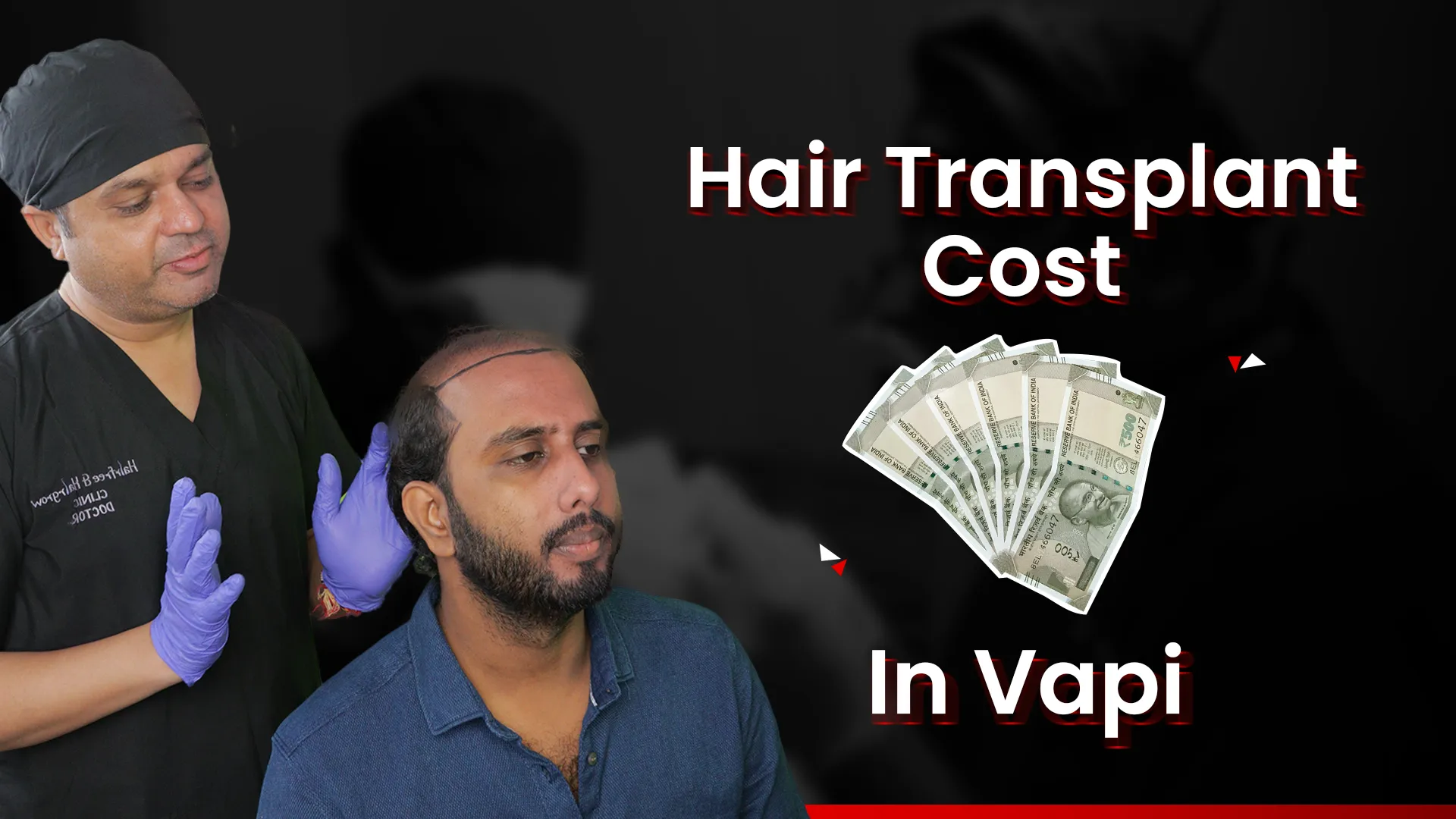 Hair Transplant Clinic in Vapi