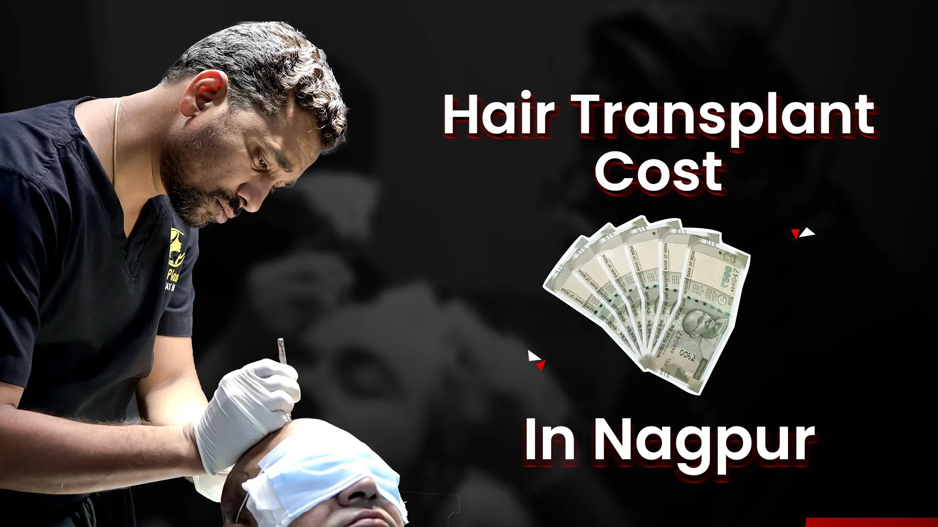 Hair Transplant Cost in Nagpur