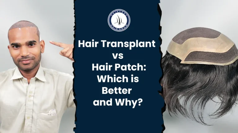 Hair Transplant vs. Hair Patch: Which is Better?