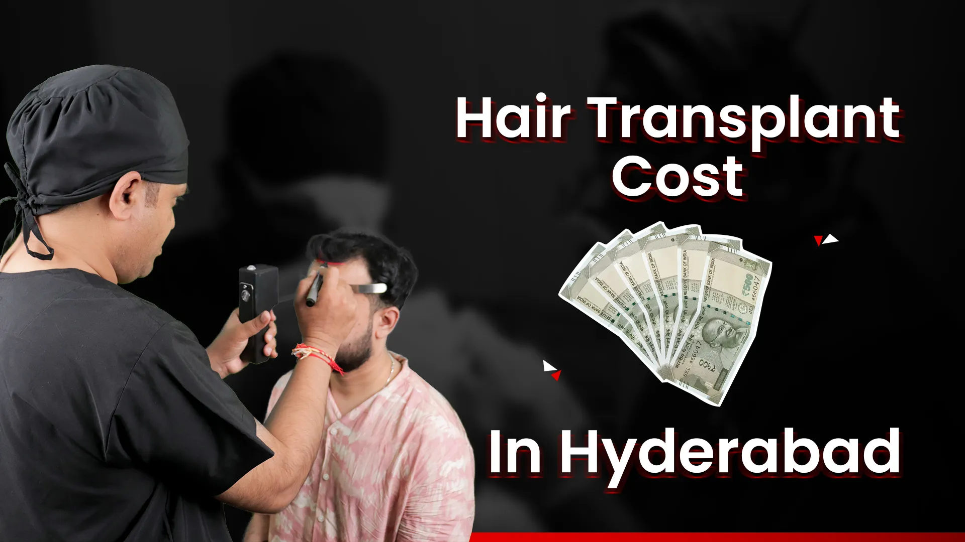 Hairtransplant Cost in Hyderabad