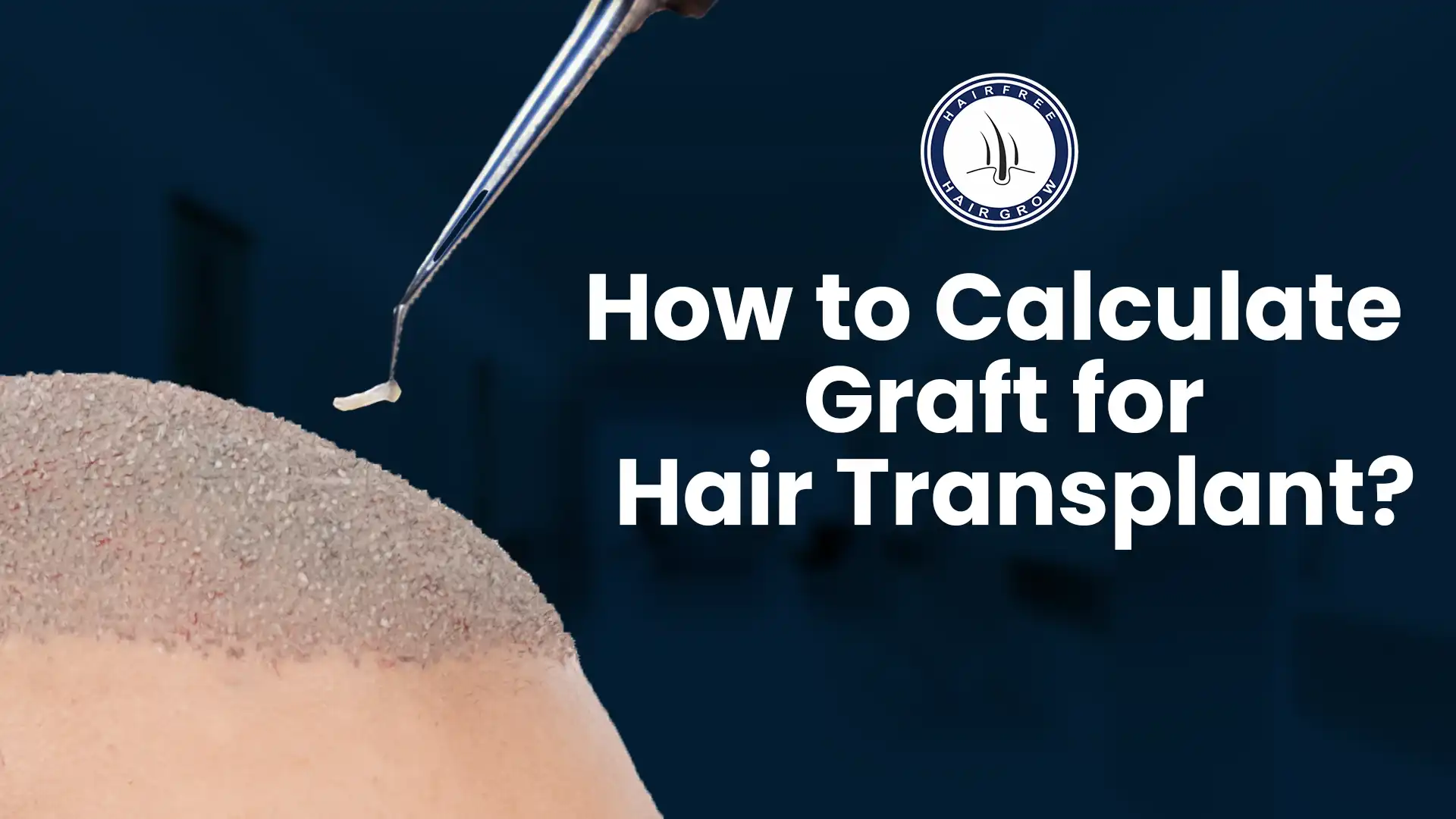 How to Calculate Graft for Hair Transplant: Easy Guide