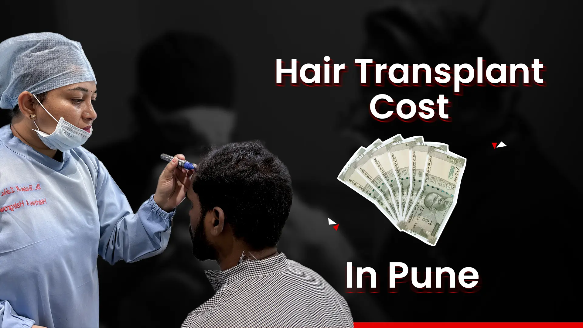 Hair Transplant Cost In Pune