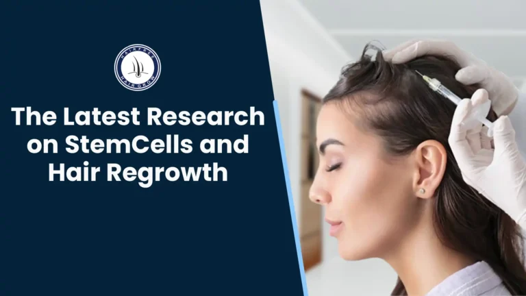 Stem Cells and Hair Regrowth – Doctor giving injection for hair treatment