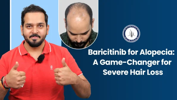 Baricitinib for Alopecia – Man showing hair regrowth success
