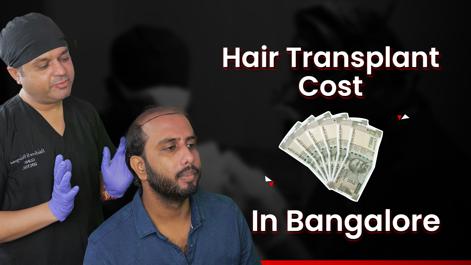 Hair Transplant In Bangalore