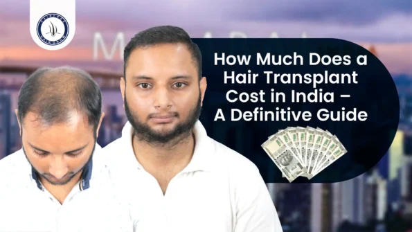 How Much Does a Hair Transplant Cost in India – Before and after hair transplant with money