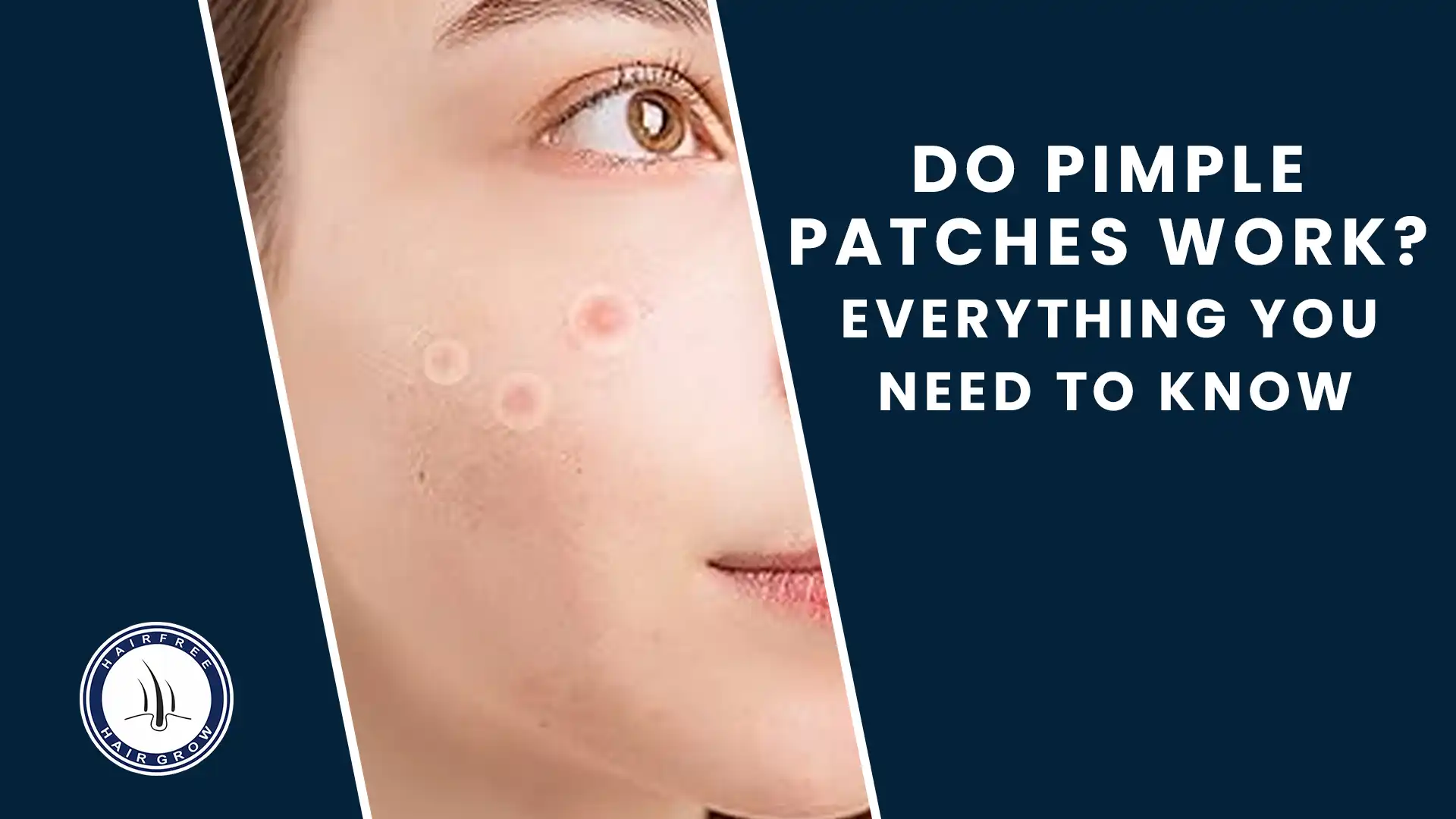 Do pimple patches work – simple guide with skin close-up