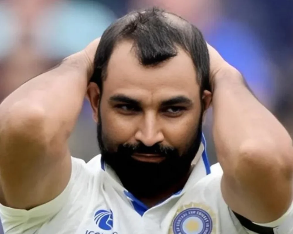 Mohammed Shami’s Battle with Hair Loss