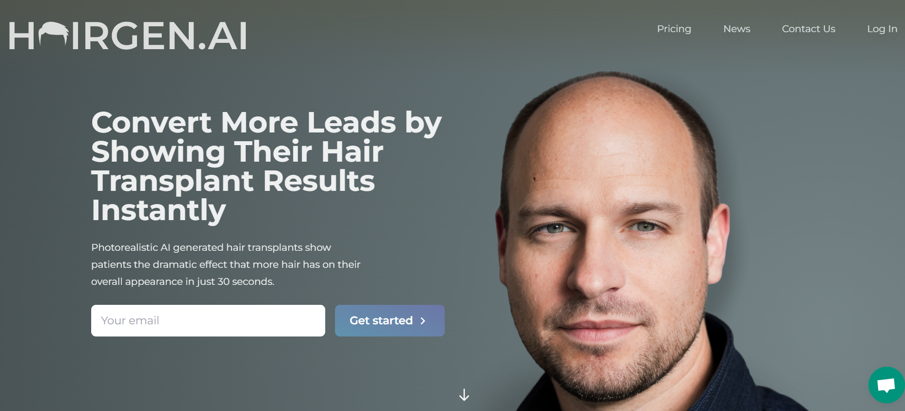 Hair transplant using AI | Hairgen.ai