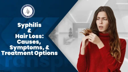 Syphilis and Hair Loss – woman worried about hair fall