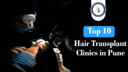 Doctors doing surgery – Top 10 Hair Transplant Clinics in Pune