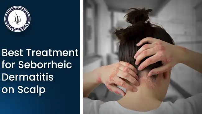 Seborrheic Dermatitis on Scalp showing red, flaky skin