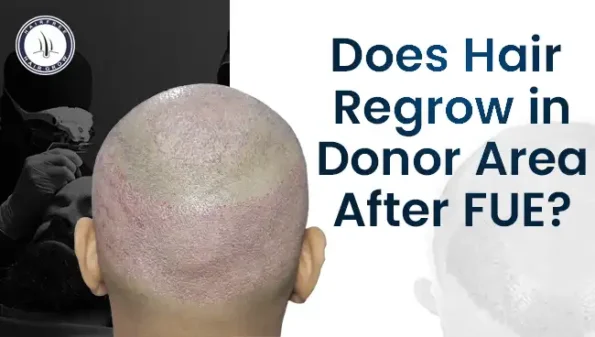 Back of shaved head after FUE – does hair regrow in donor area after FUE