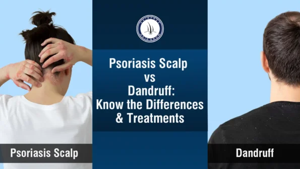 Psoriasis scalp vs dandruff difference shown on hair and scalp