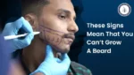 Man getting beard area marked – signs you can’t grow a beard.