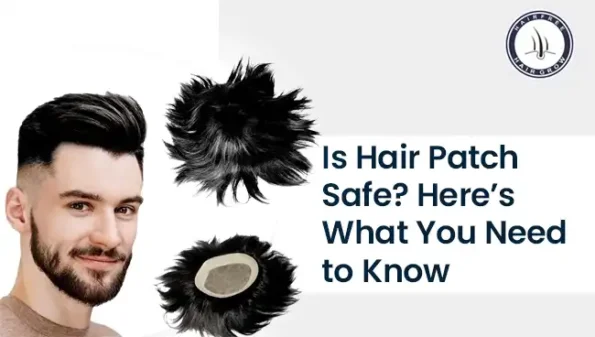 Man wearing hair patch – is hair patch safe to use