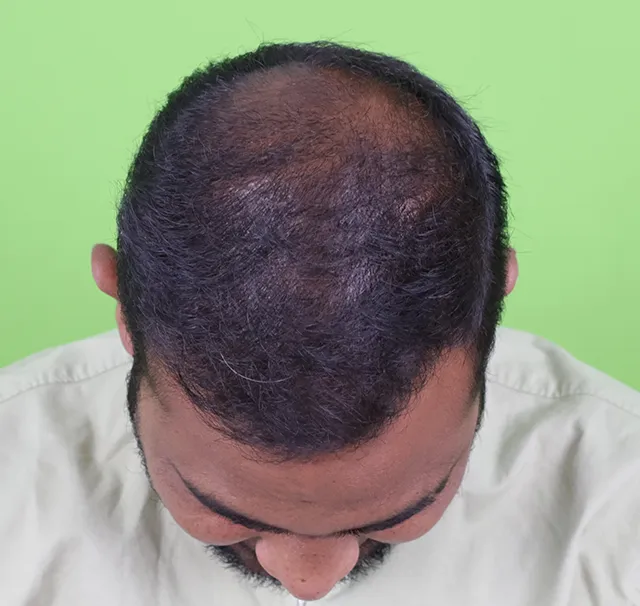 5 months top