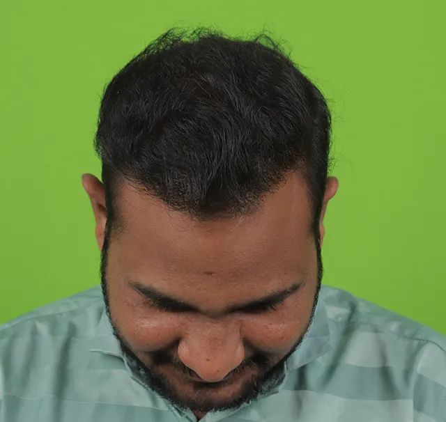 7 months top