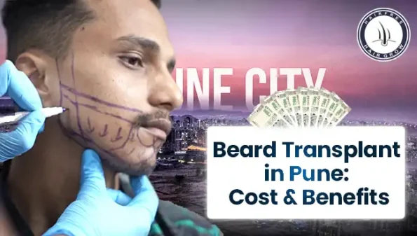 Beard Transplant in Pune – Get Natural Beard Growth