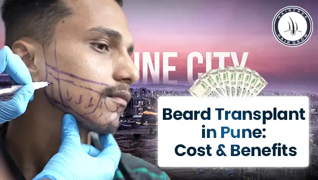 Beard Transplant in Pune – Get Natural Beard Growth