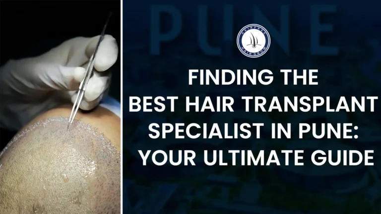 Hair Transplant Specialist in Pune doing hair grafting treatment