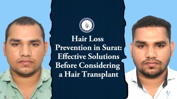 Hair Loss Prevention in Surat – Easy Tips for Healthy Hair