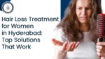 Hair loss treatment for women in Hyderabad with effective solutions