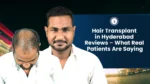 Hair transplant in Hyderabad reviews with before and after result