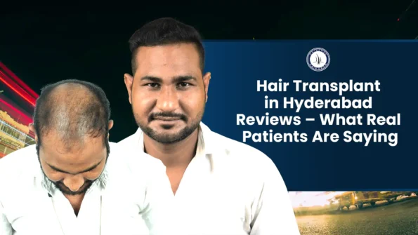 Hair transplant in Hyderabad reviews with before and after result