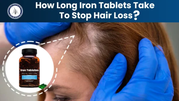 How long iron tablets take to stop hair loss shown