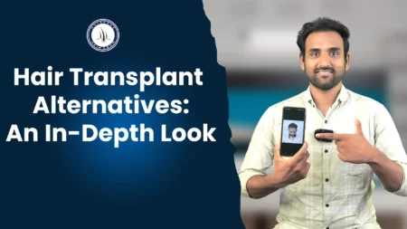 Hair Transplant Alternatives An In Depth Look