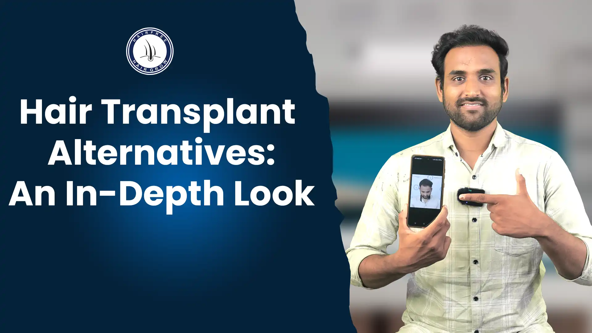 Hair Transplant Alternatives An In Depth Look
