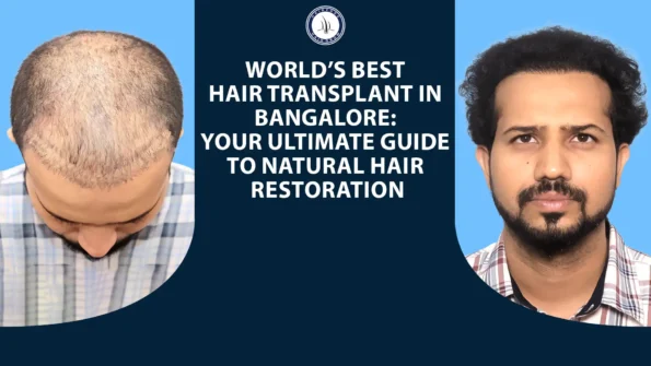 Best Hair Transplants in Bangalore for Hair Restoration