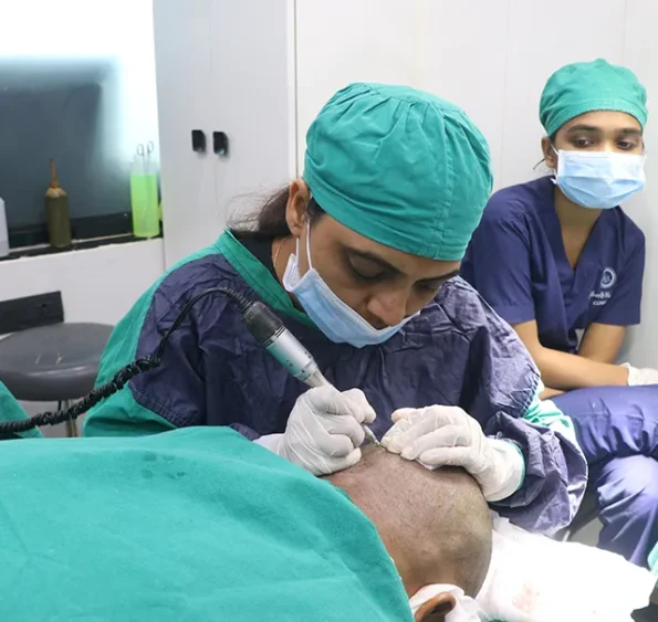 Extracting follicular grafts with 0.8 mm punch during FUE in Ludhiana