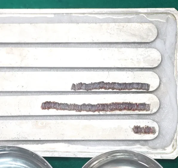 Technicians organizing grafts in petri dish with chiller before implantation