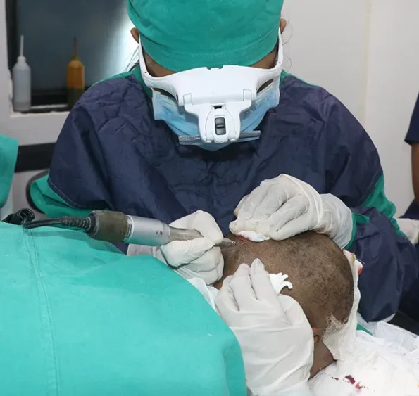 Close-up of graft extraction from occipital donor area