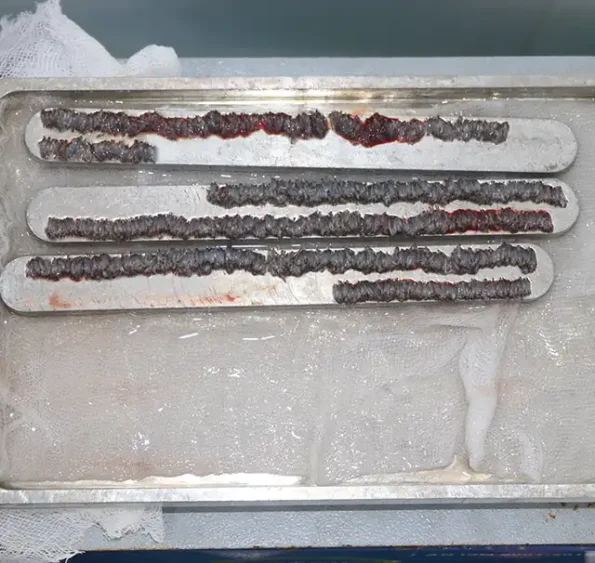 Harvested grafts stored in chilled saline tray to maintain viability