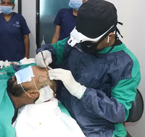 Recipient zones marked on thinning crown ahead of graft placement
