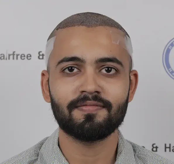 Immediate post-op frontal view with implanted grafts and dressing