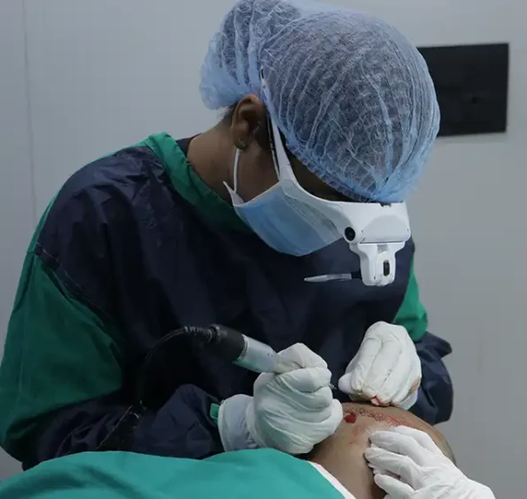 Close-up of graft extraction from occipital donor area