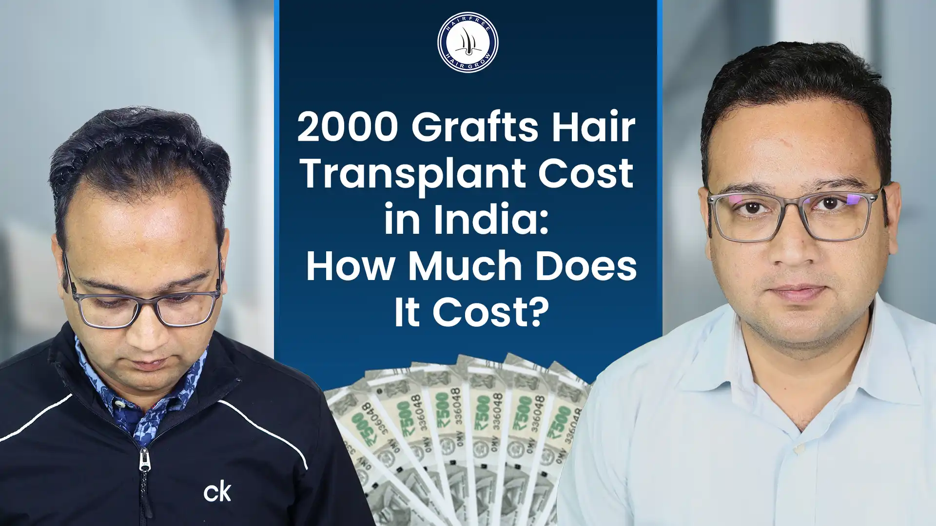 This Infographic Shows 2000 Grafts Hair Transplant Cost in India How Much Does It Cost
