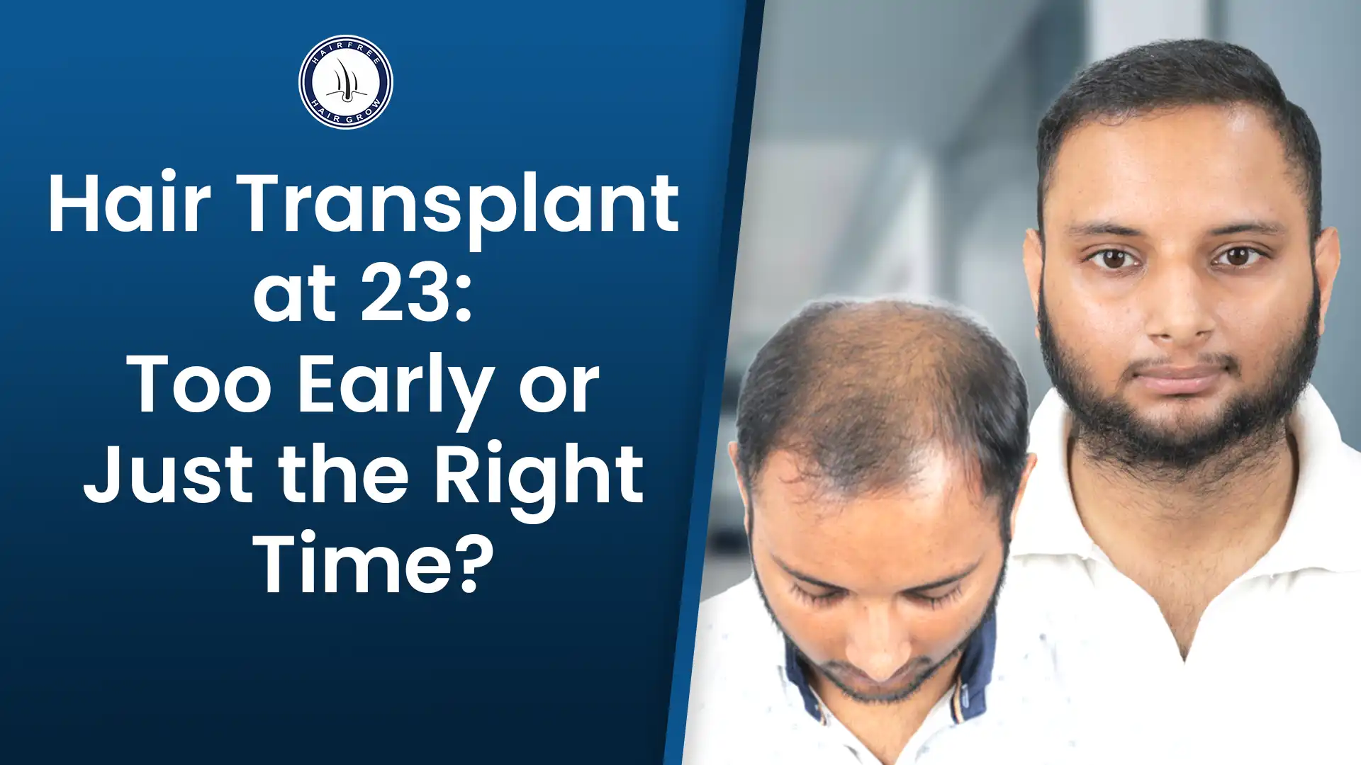 This infographic show how Hair Transplant at 23