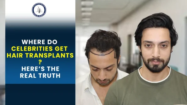 Where Do Celebrities Get Hair Transplants Here s the Real Truth