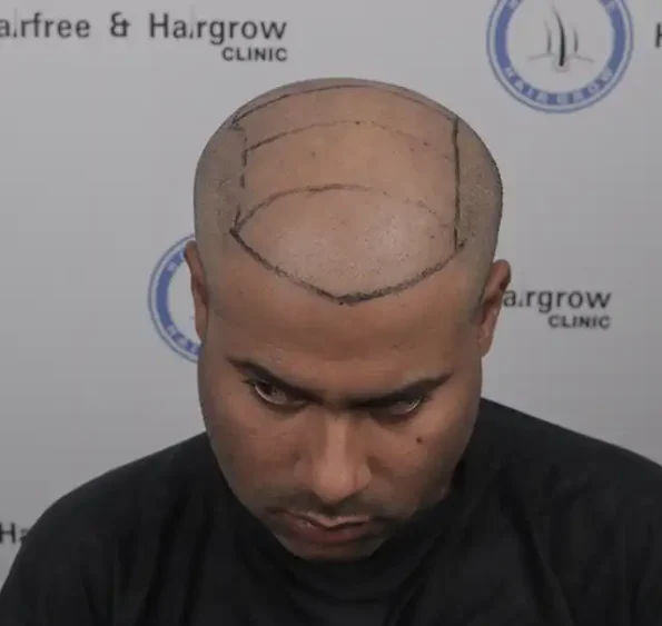 4 1