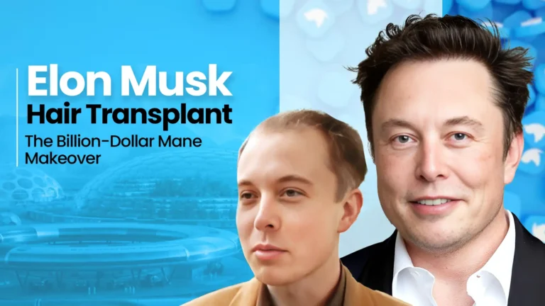 This info graphic show Elon Musk Hair Before-After results Case studies