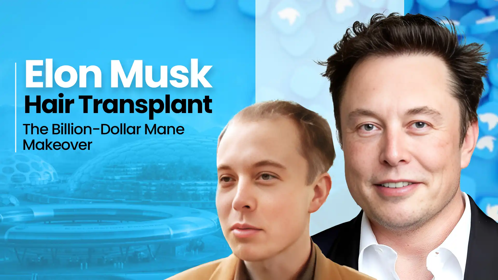 Elon Musk Hair Transplant | Before & After Journey
